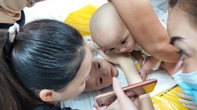 Ảnh: Hai bé gái song sinh dính liền vào phòng phẫu thuật