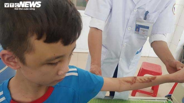 Bắc Ninh ra văn bản hỏa tốc sau vụ nhân viên quán bánh xèo bị tra tấn