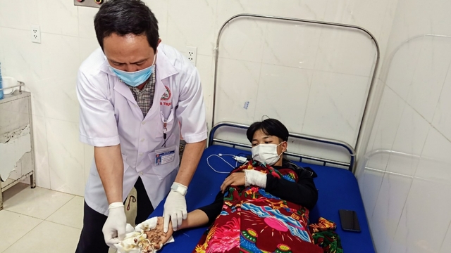 Nhiều trường hợp thương tích nặng do tai nạn pháo nổ ở Đắk Lắk