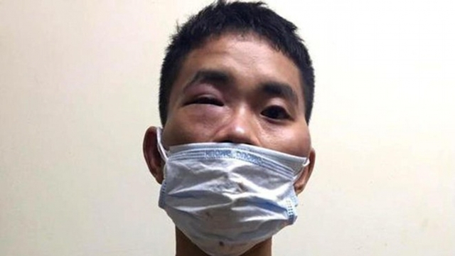 Đối tượng nghi “ngáo đá” túm tóc cán bộ trực chốt đòi lại xe máy