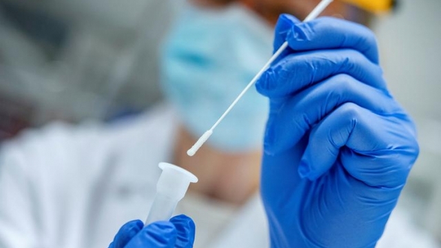 Thái Lan hoãn mua 8,5 triệu bộ xét nghiệm nhanh Covid-19 do nghi ngờ chất lượng