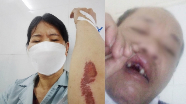 Điều tra vụ nhóm côn đồ đánh một cụm phó dân cư xã nhập viện