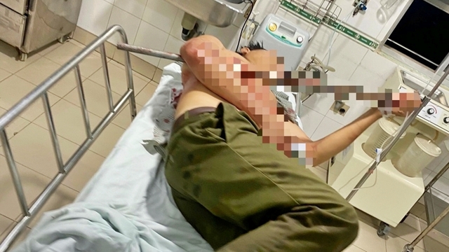Ngăn chặn nhóm thanh niên hỗn chiến, tổ trưởng tổ dân phòng bị đâm