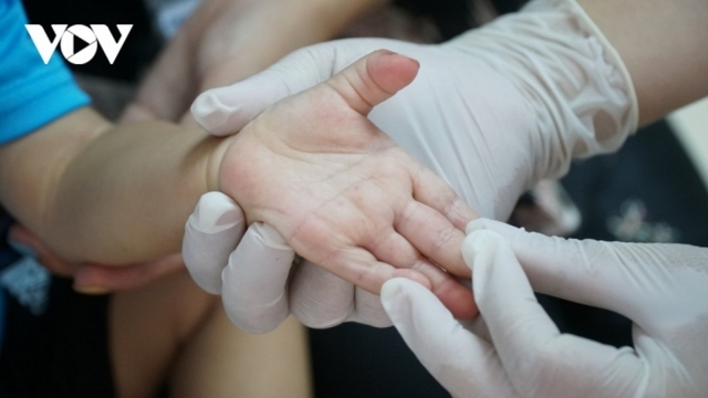 Three die of HFM disease, Health Ministry asks for more preventive measures