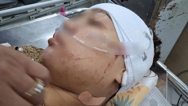 Nữ công chức rạch mặt “tình địch” vì ghen tuông đối mặt vòng lao lý