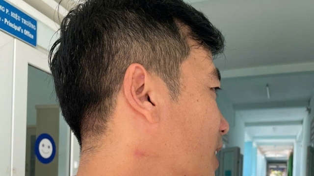 5 lần bị kỷ luật, thầy giáo vẫn bóp cổ đồng nghiệp giữa sân trường