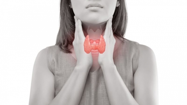 U cường giáp kèm thiếu máu do kinh nguyệt: Những lưu ý quan trọng khi dùng sắt