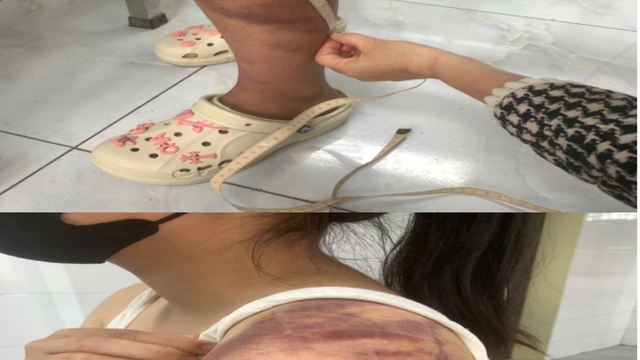 Tạm giữ người đàn ông bạo hành vợ đang mang thai và con gái 13 tuổi ở Bắc Ninh