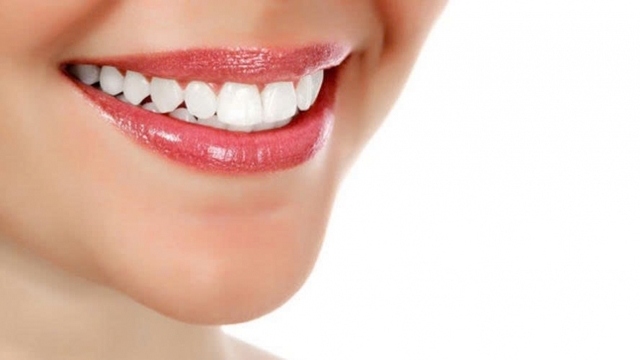 Bật mí những phương pháp làm trắng răng an toàn, dễ áp dụng