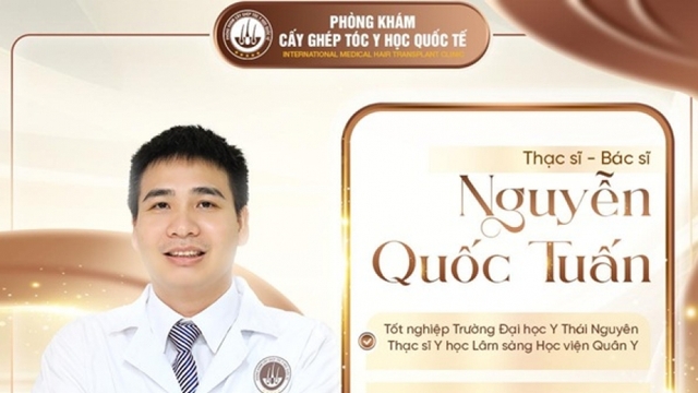 Cấy tóc tự thân trở thành xu hướng thẩm mỹ được nhiều người quan tâm