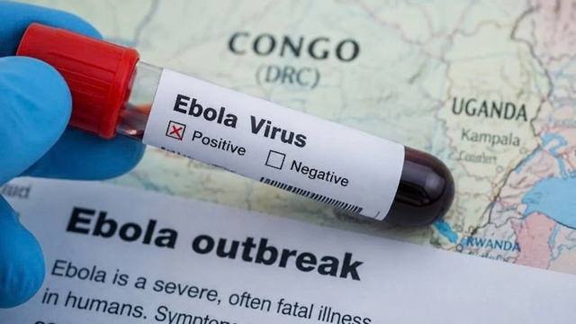 Bộ Y tế bổ sung quy định về dấu hiệu nhận biết, giám sát bệnh do virus Ebola