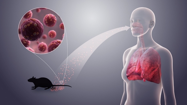 Triệu chứng nhiễm virus Hanta dễ nhầm với các bệnh khác, làm gì để phòng ngừa?