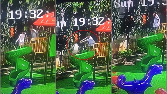 Bé gái bị xô ngã từ cầu trượt cao 1,5m ở sân chơi, nứt xương hốc mắt và tụ máu đầu