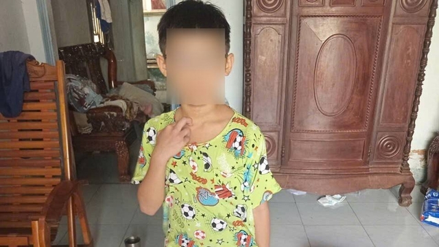 Công an làm việc với người cha đánh con trai 8 tuổi ở TP.HCM