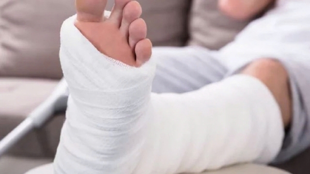 Bị gãy chân có nên quan hệ vợ chồng hàng ngày?