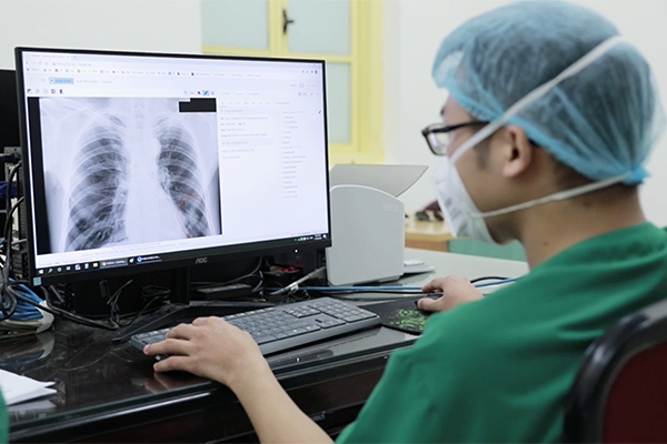 AI technology is applied in tuberculosis prevention in Vietnam