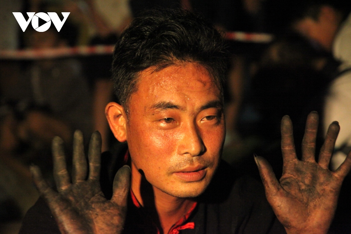 A young man shows his hands which appears black and without burns after the performance.
