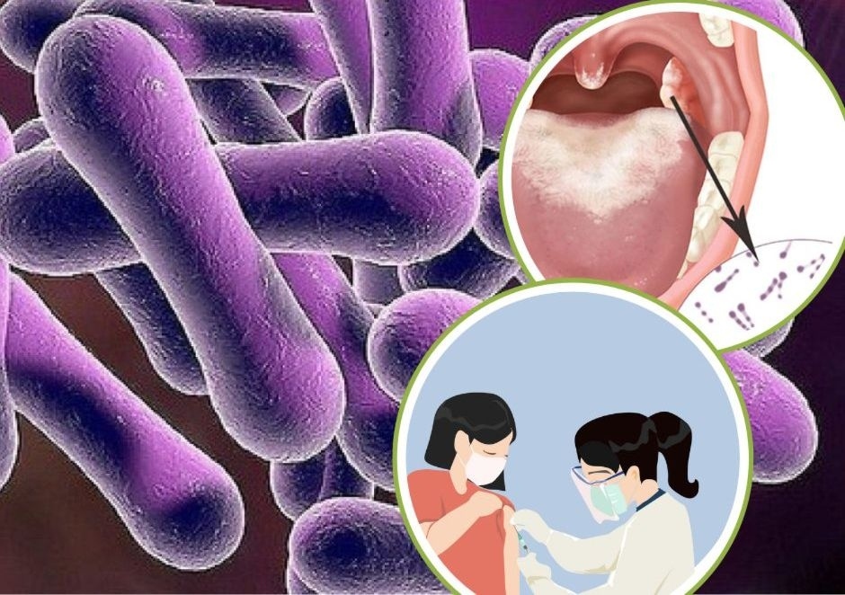 The Ministry of Health has played down concerns about a diphtheria epidemic in Vietnam following the detection of several cases in Nghe An and Bac Giang provinces. (Illustration)