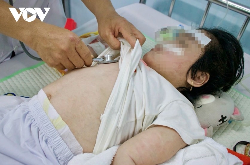 A child infected with measles is given medical checkups at a hospital in Hanoi.
