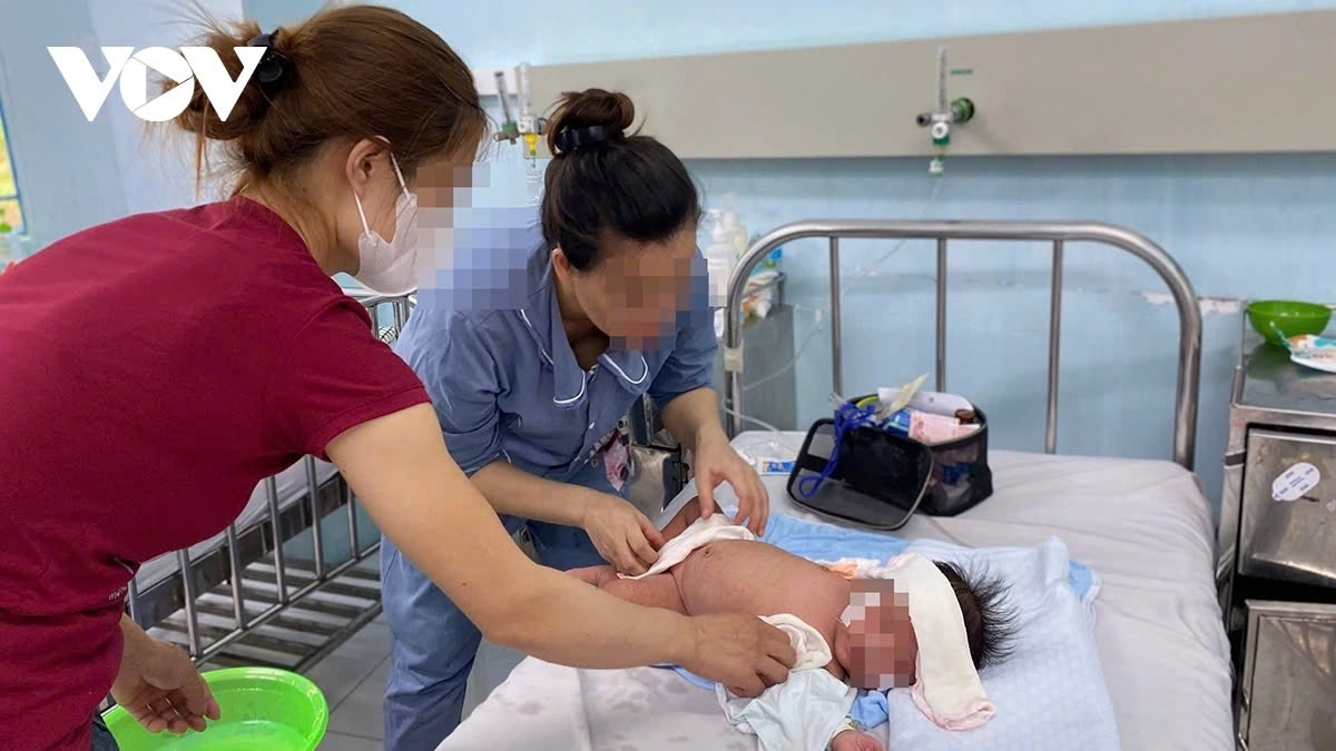 Caring for a child patient with measles in Hanoi