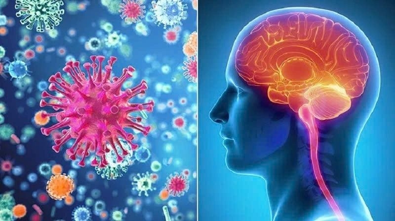 Doctor say meningococcal disease can be life-threatening and progress rapidly., and without timely treatment, the fatality rate can reach up to 50% within 24 to 48 hours